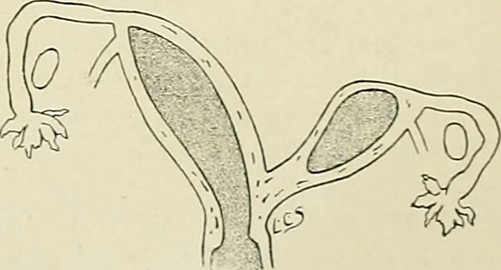 An illustration from Obstetrics : a text-book for the use of students and practitioners / by J. Whitridge Williams ... with eight coloured plates and six hundred and thirty illustrations in the text., 1903, leaf 521