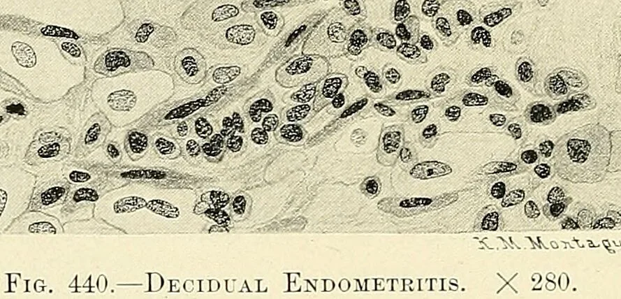 An illustration from Obstetrics : a text-book for the use of students and practitioners / by J. Whitridge Williams ... with eight coloured plates and six hundred and thirty illustrations in the text., 1903, leaf 534