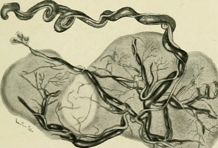 An illustration from Obstetrics : a text-book for the use of students and practitioners / by J. Whitridge Williams ... with eight coloured plates and six hundred and thirty illustrations in the text., 1903, leaf 551