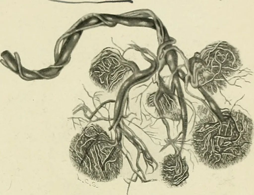 An illustration from Obstetrics : a text-book for the use of students and practitioners / by J. Whitridge Williams ... with eight coloured plates and six hundred and thirty illustrations in the text., 1903, leaf 553