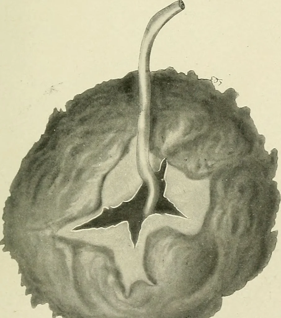 An illustration from Obstetrics : a text-book for the use of students and practitioners / by J. Whitridge Williams ... with eight coloured plates and six hundred and thirty illustrations in the text., 1903, leaf 553