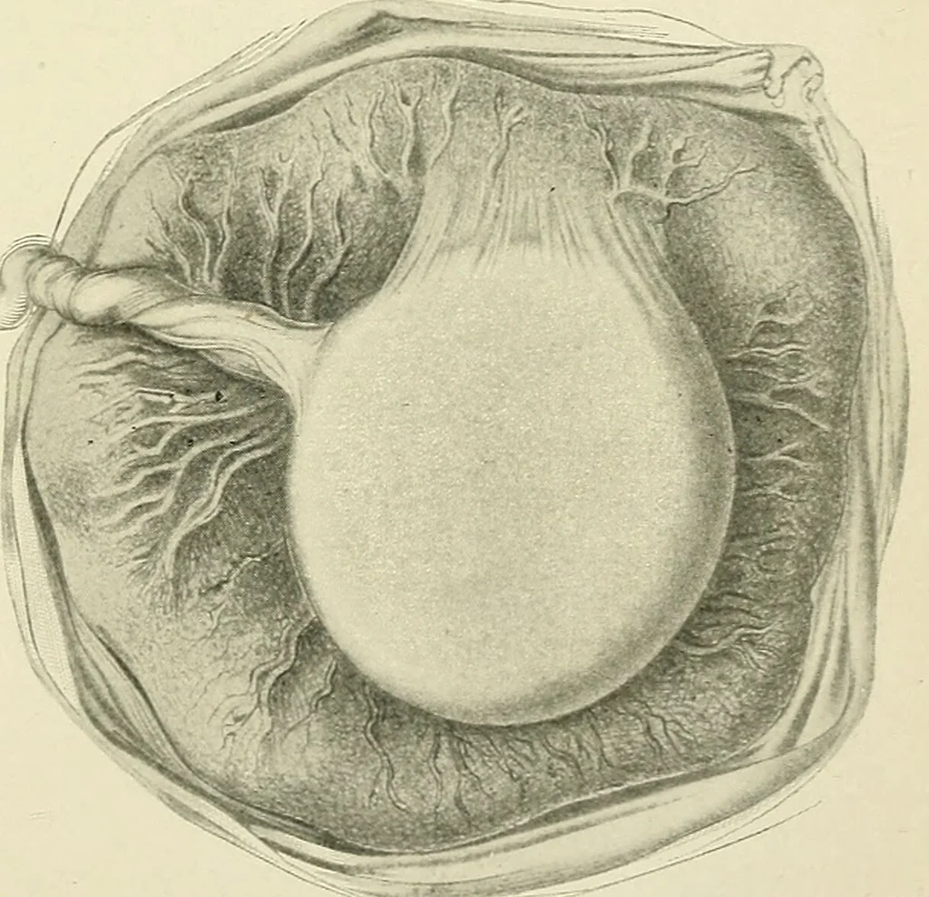 An illustration from Obstetrics : a text-book for the use of students and practitioners / by J. Whitridge Williams ... with eight coloured plates and six hundred and thirty illustrations in the text., 1903, leaf 559