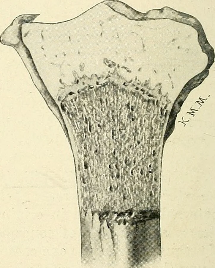 An illustration from Obstetrics : a text-book for the use of students and practitioners / by J. Whitridge Williams ... with eight coloured plates and six hundred and thirty illustrations in the text., 1903, leaf 566