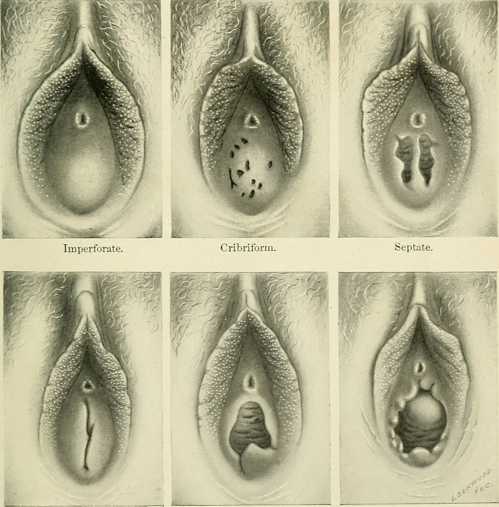 An illustration from Obstetrics : a text-book for the use of students and practitioners / by J. Whitridge Williams ... with eight coloured plates and six hundred and thirty illustrations in the text., 1903, leaf 57