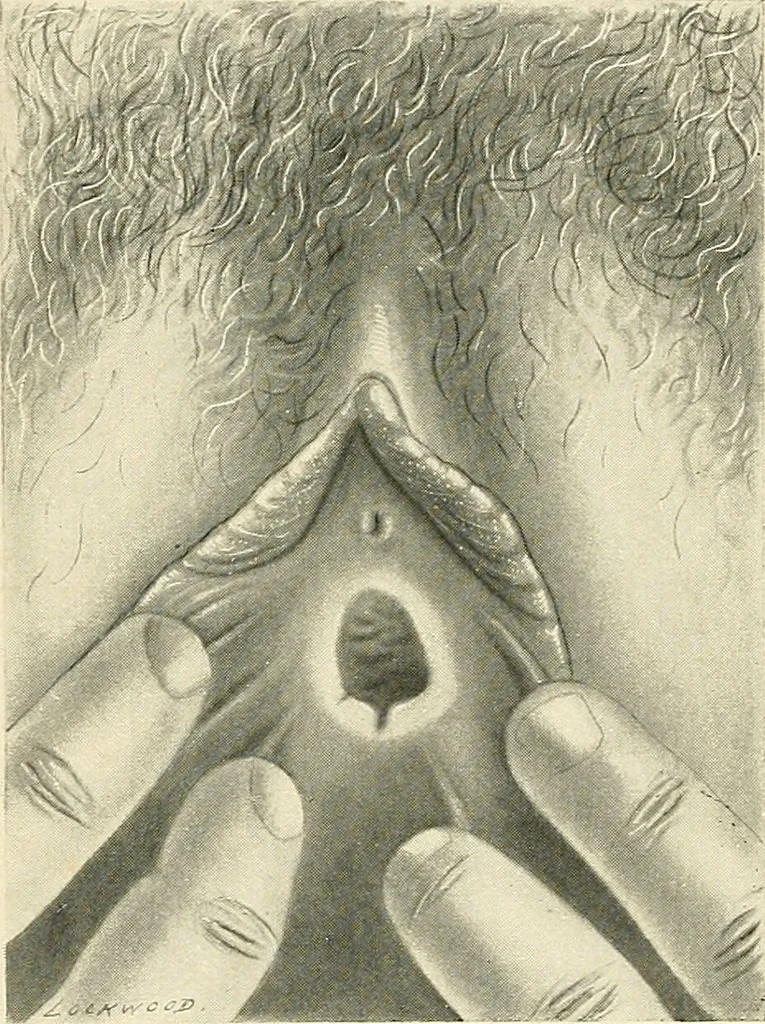An illustration from Obstetrics : a text-book for the use of students and practitioners / by J. Whitridge Williams ... with eight coloured plates and six hundred and thirty illustrations in the text., 1903, leaf 60