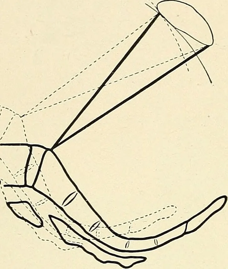 An illustration from Obstetrics : a text-book for the use of students and practitioners / by J. Whitridge Williams ... with eight coloured plates and six hundred and thirty illustrations in the text., 1903, leaf 644