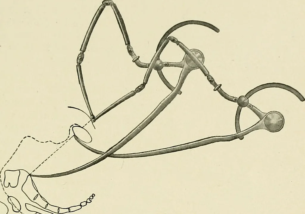 An illustration from Obstetrics : a text-book for the use of students and practitioners / by J. Whitridge Williams ... with eight coloured plates and six hundred and thirty illustrations in the text., 1903, leaf 645