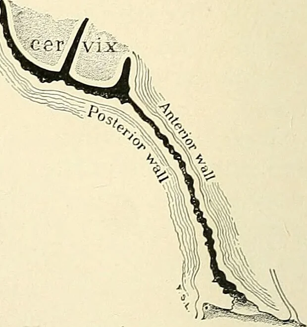 An illustration from Obstetrics : a text-book for the use of students and practitioners / by J. Whitridge Williams ... with eight coloured plates and six hundred and thirty illustrations in the text., 1903, leaf 66