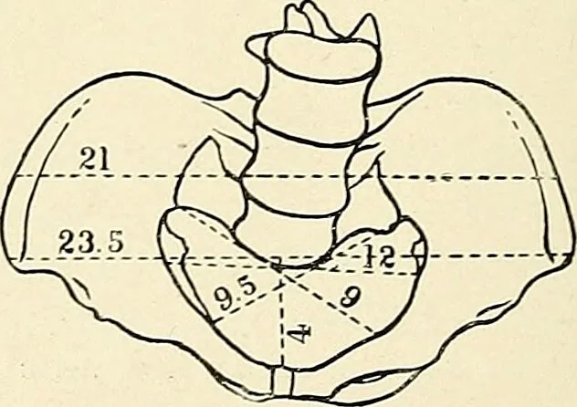 An illustration from Obstetrics : a text-book for the use of students and practitioners / by J. Whitridge Williams ... with eight coloured plates and six hundred and thirty illustrations in the text., 1903, leaf 660