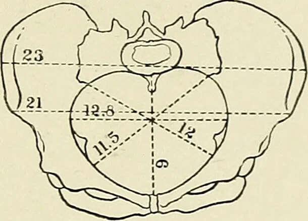 An illustration from Obstetrics : a text-book for the use of students and practitioners / by J. Whitridge Williams ... with eight coloured plates and six hundred and thirty illustrations in the text., 1903, leaf 661