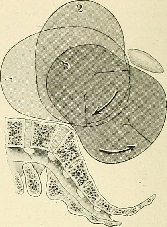 An illustration from Obstetrics : a text-book for the use of students and practitioners / by J. Whitridge Williams ... with eight coloured plates and six hundred and thirty illustrations in the text., 1903, leaf 674