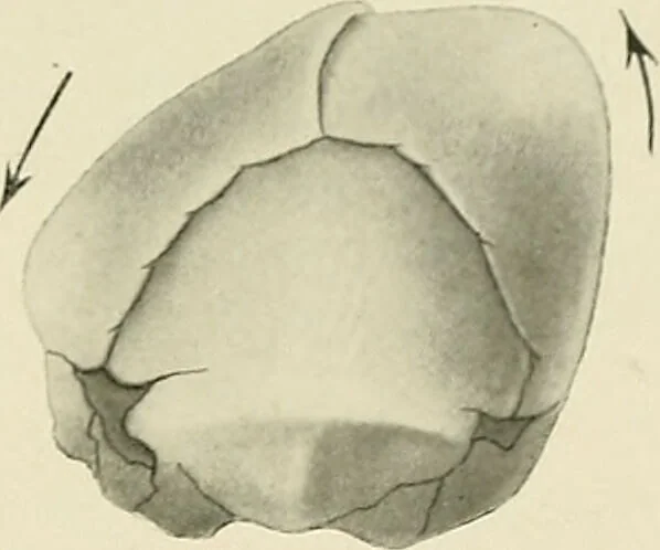 An illustration from Obstetrics : a text-book for the use of students and practitioners / by J. Whitridge Williams ... with eight coloured plates and six hundred and thirty illustrations in the text., 1903, leaf 679