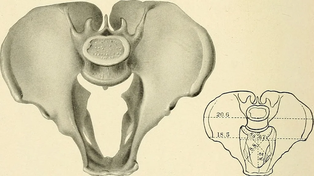 An illustration from Obstetrics : a text-book for the use of students and practitioners / by J. Whitridge Williams ... with eight coloured plates and six hundred and thirty illustrations in the text., 1903, leaf 700