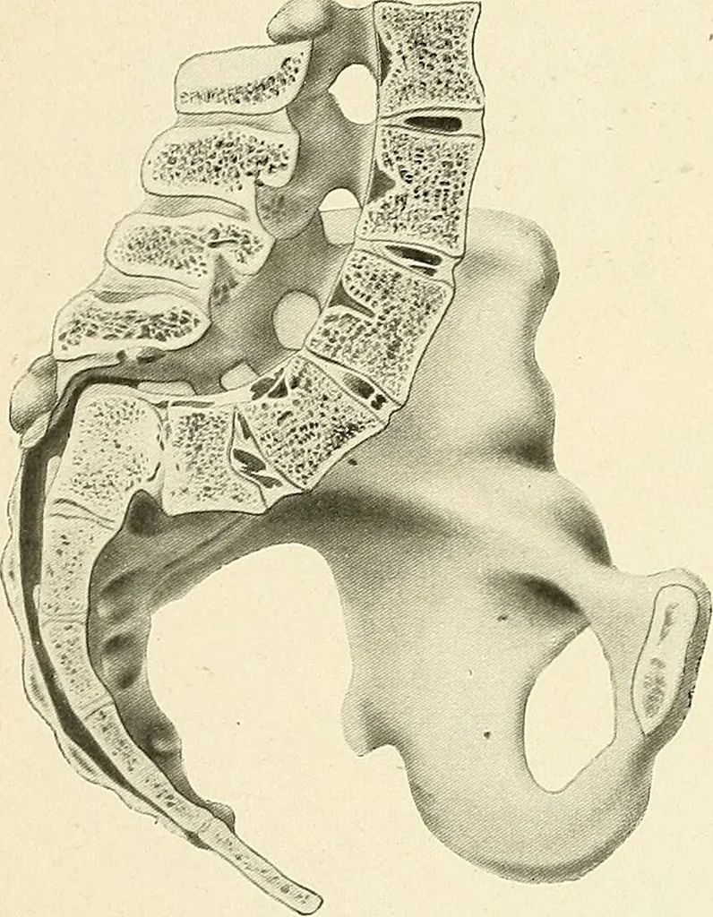 An illustration from Obstetrics : a text-book for the use of students and practitioners / by J. Whitridge Williams ... with eight coloured plates and six hundred and thirty illustrations in the text., 1903, leaf 718