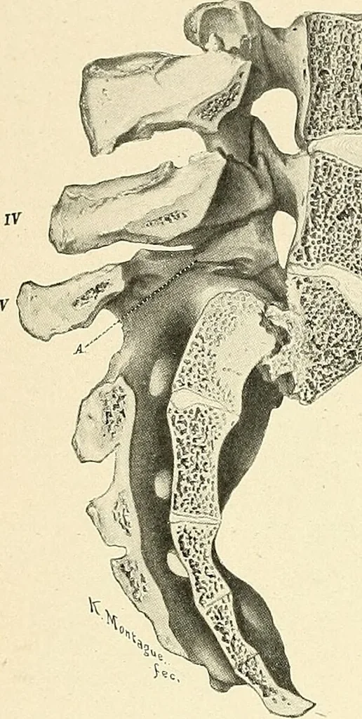 An illustration from Obstetrics : a text-book for the use of students and practitioners / by J. Whitridge Williams ... with eight coloured plates and six hundred and thirty illustrations in the text., 1903, leaf 720