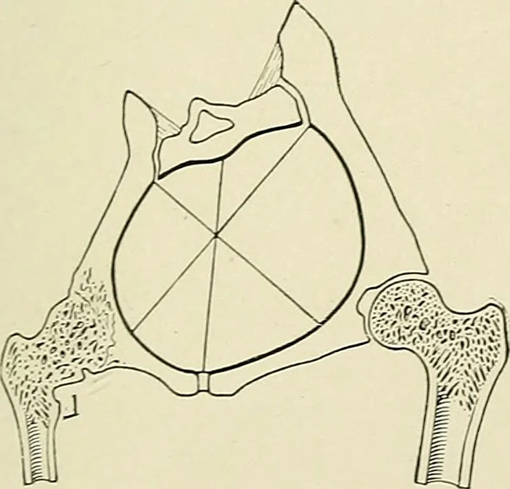 An illustration from Obstetrics : a text-book for the use of students and practitioners / by J. Whitridge Williams ... with eight coloured plates and six hundred and thirty illustrations in the text., 1903, leaf 725