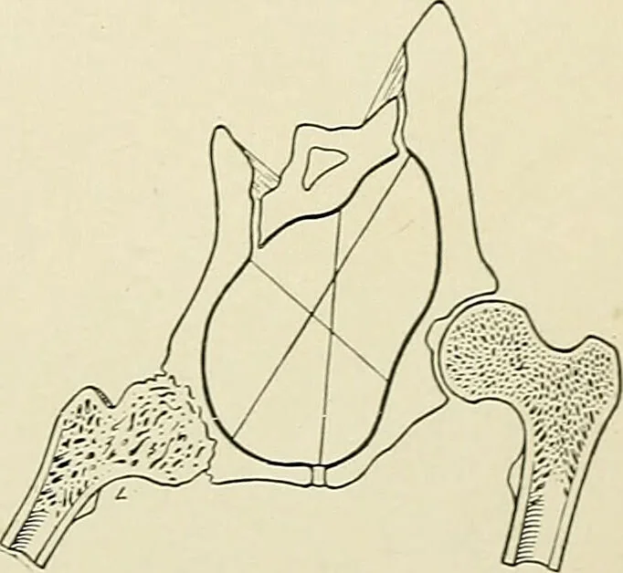 An illustration from Obstetrics : a text-book for the use of students and practitioners / by J. Whitridge Williams ... with eight coloured plates and six hundred and thirty illustrations in the text., 1903, leaf 725