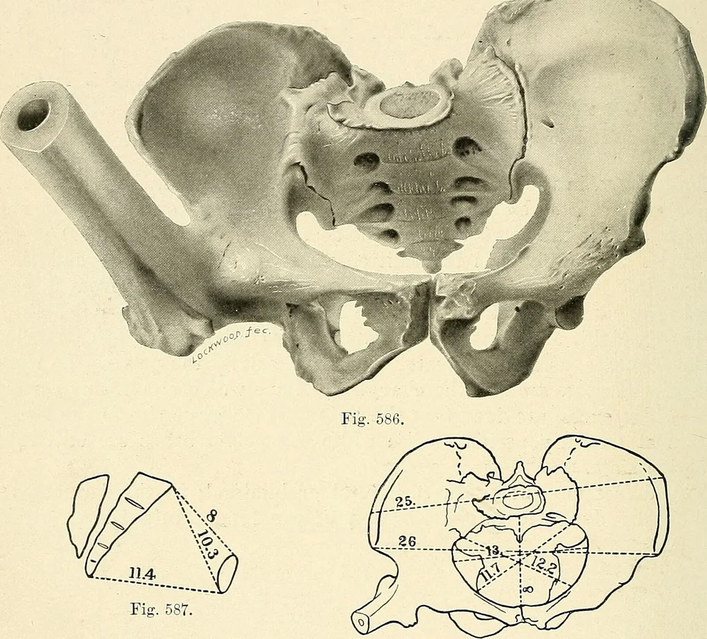 An illustration from Obstetrics : a text-book for the use of students and practitioners / by J. Whitridge Williams ... with eight coloured plates and six hundred and thirty illustrations in the text., 1903, leaf 726