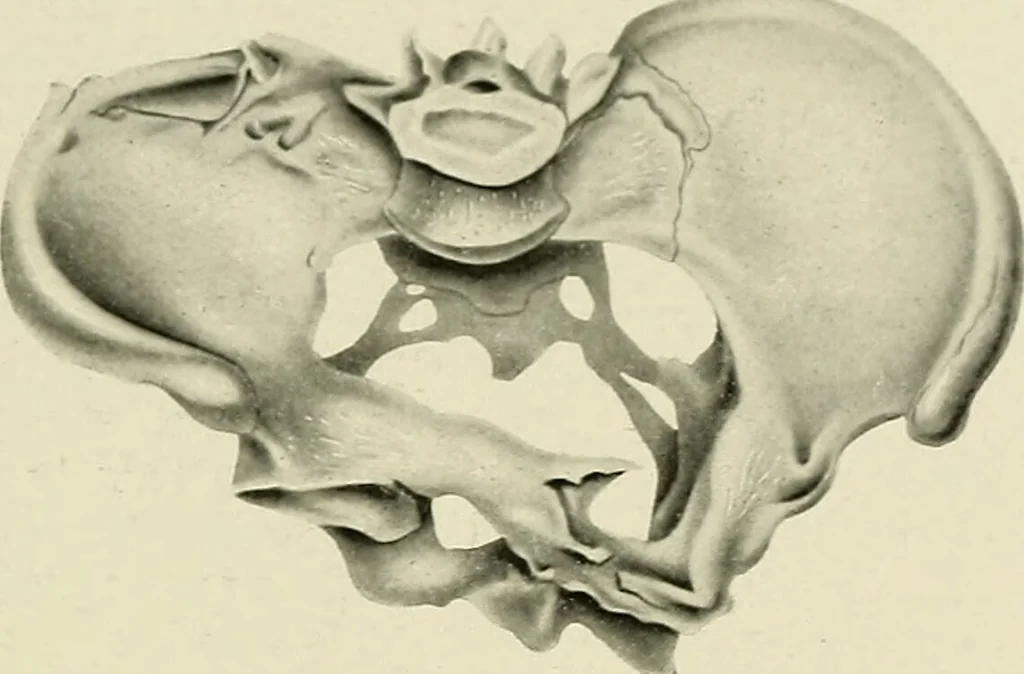 An illustration from Obstetrics : a text-book for the use of students and practitioners / by J. Whitridge Williams ... with eight coloured plates and six hundred and thirty illustrations in the text., 1903, leaf 731