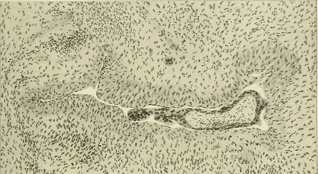 An illustration from Obstetrics : a text-book for the use of students and practitioners / by J. Whitridge Williams ... with eight coloured plates and six hundred and thirty illustrations in the text., 1903, leaf 757