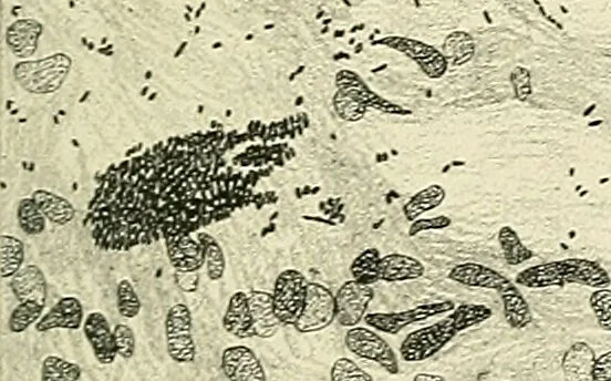 An illustration from Obstetrics : a text-book for the use of students and practitioners / by J. Whitridge Williams ... with eight coloured plates and six hundred and thirty illustrations in the text., 1903, leaf 825