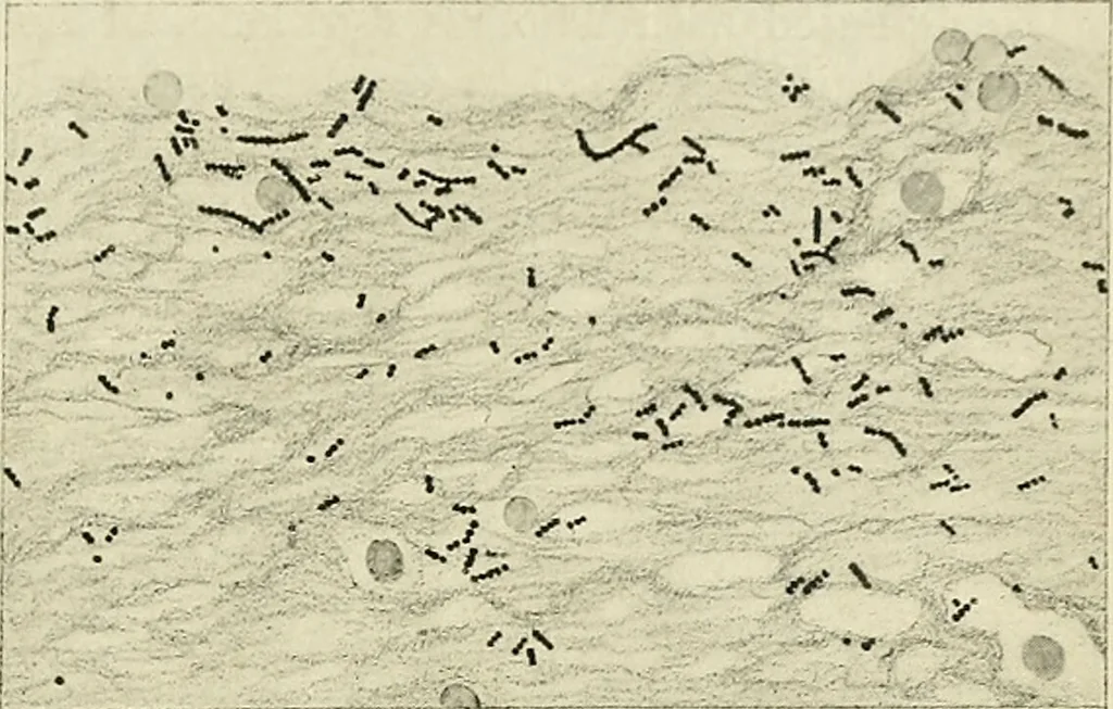An illustration from Obstetrics : a text-book for the use of students and practitioners / by J. Whitridge Williams ... with eight coloured plates and six hundred and thirty illustrations in the text., 1903, leaf 827