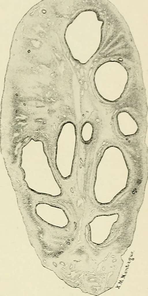 An illustration from Obstetrics : a text-book for the use of students and practitioners / by J. Whitridge Williams ... with eight coloured plates and six hundred and thirty illustrations in the text., 1903, leaf 87