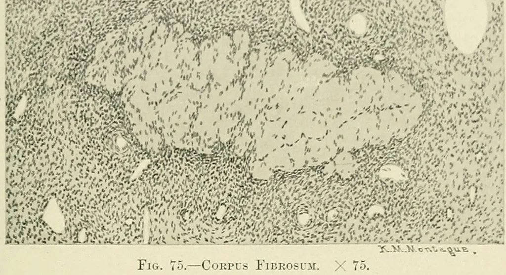 An illustration from Obstetrics : a text-book for the use of students and practitioners / by J. Whitridge Williams ... with eight coloured plates and six hundred and thirty illustrations in the text., 1903, leaf 99