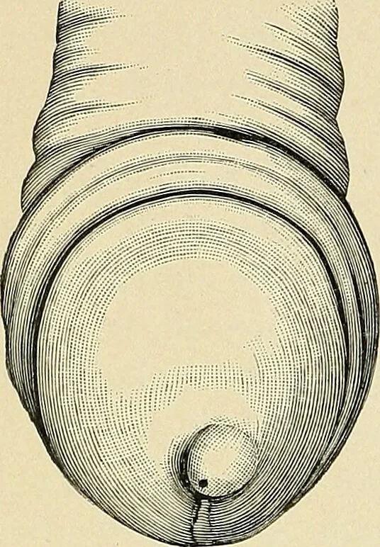An illustration from A practical treatise on genito-urinary and venereal diseases and syphilis / By Robert W. Taylor., 1904, leaf 140