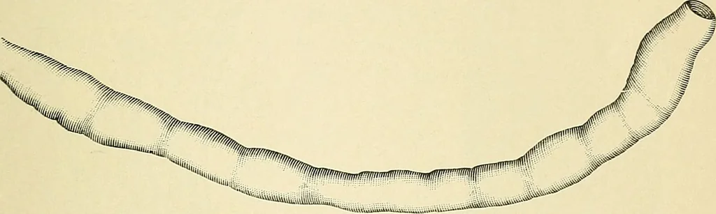 An illustration from A practical treatise on genito-urinary and venereal diseases and syphilis / By Robert W. Taylor., 1904, leaf 211