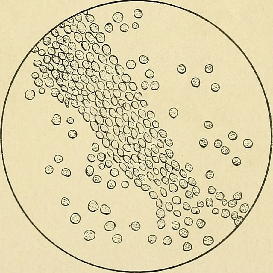 An illustration from A practical treatise on genito-urinary and venereal diseases and syphilis / By Robert W. Taylor., 1904, leaf 35