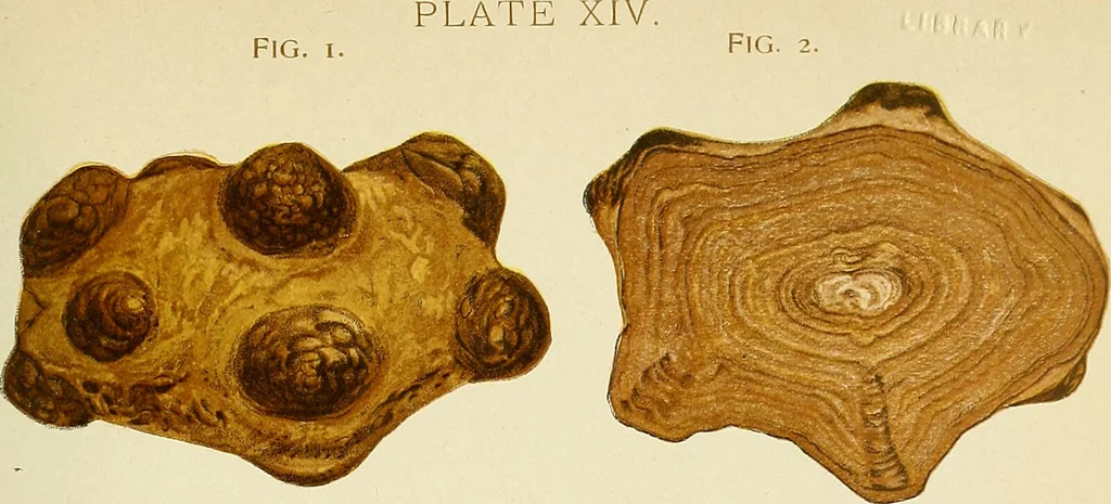 An illustration from A practical treatise on genito-urinary and venereal diseases and syphilis / By Robert W. Taylor., 1904, leaf 403