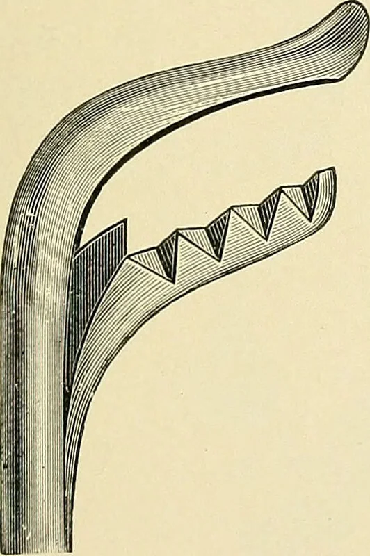 An illustration from A practical treatise on genito-urinary and venereal diseases and syphilis / By Robert W. Taylor., 1904, leaf 411