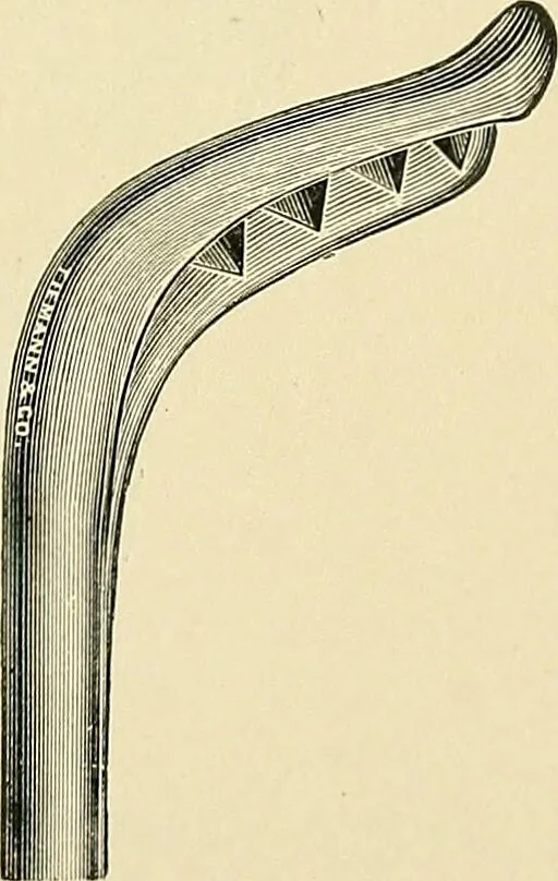 An illustration from A practical treatise on genito-urinary and venereal diseases and syphilis / By Robert W. Taylor., 1904, leaf 411