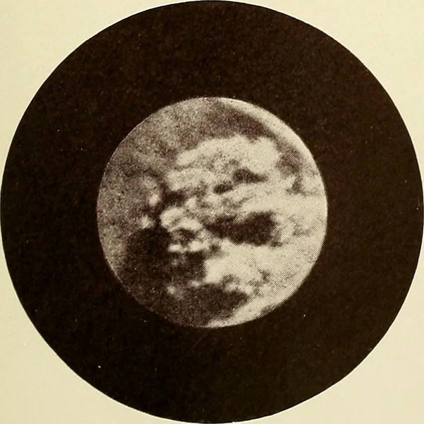 An illustration from A practical treatise on genito-urinary and venereal diseases and syphilis / By Robert W. Taylor., 1904, leaf 427