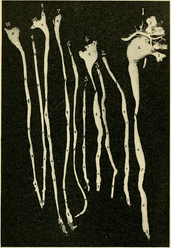 An illustration from A practical treatise on genito-urinary and venereal diseases and syphilis / By Robert W. Taylor., 1904, leaf 437