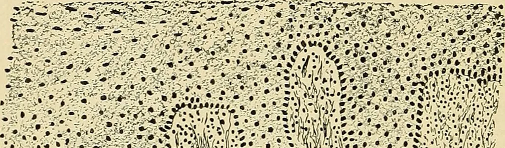 An illustration from A practical treatise on genito-urinary and venereal diseases and syphilis / By Robert W. Taylor., 1904, leaf 546