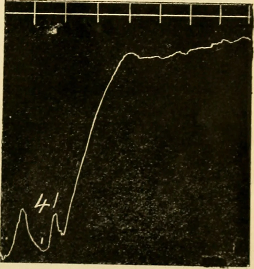An illustration from A manual of physiology : with practical exercises / by G. N. Stewart ; with coloured plate and 467 other illustrations., 1914, leaf 1125