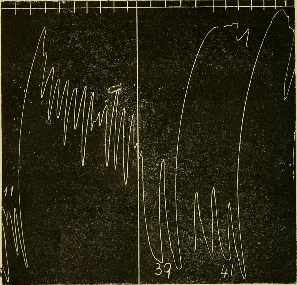 An illustration from A manual of physiology : with practical exercises / by G. N. Stewart ; with coloured plate and 467 other illustrations., 1914, leaf 1126
