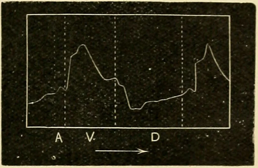 An illustration from A manual of physiology : with practical exercises / by G. N. Stewart ; with coloured plate and 467 other illustrations., 1914, leaf 115