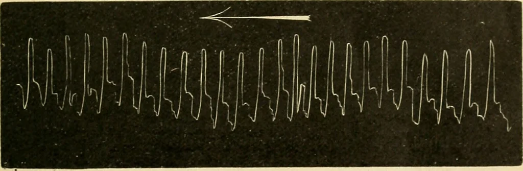 An illustration from A manual of physiology : with practical exercises / by G. N. Stewart ; with coloured plate and 467 other illustrations., 1914, leaf 153