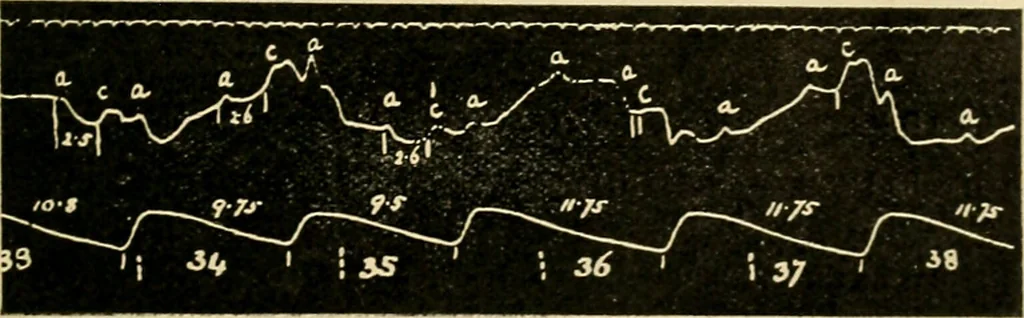 An illustration from A manual of physiology : with practical exercises / by G. N. Stewart ; with coloured plate and 467 other illustrations., 1914, leaf 173