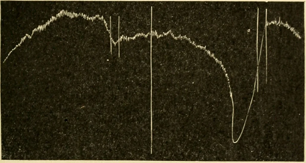 An illustration from A manual of physiology : with practical exercises / by G. N. Stewart ; with coloured plate and 467 other illustrations., 1914, leaf 197