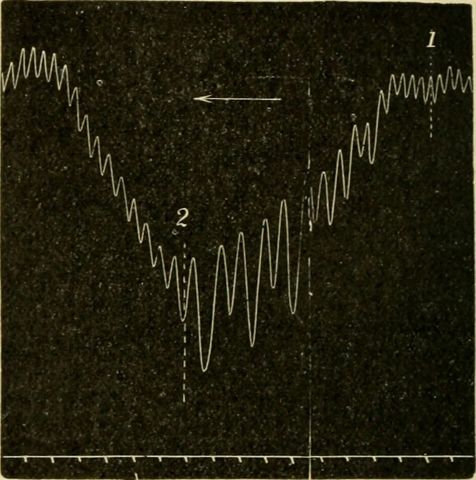 An illustration from A manual of physiology : with practical exercises / by G. N. Stewart ; with coloured plate and 467 other illustrations., 1914, leaf 208