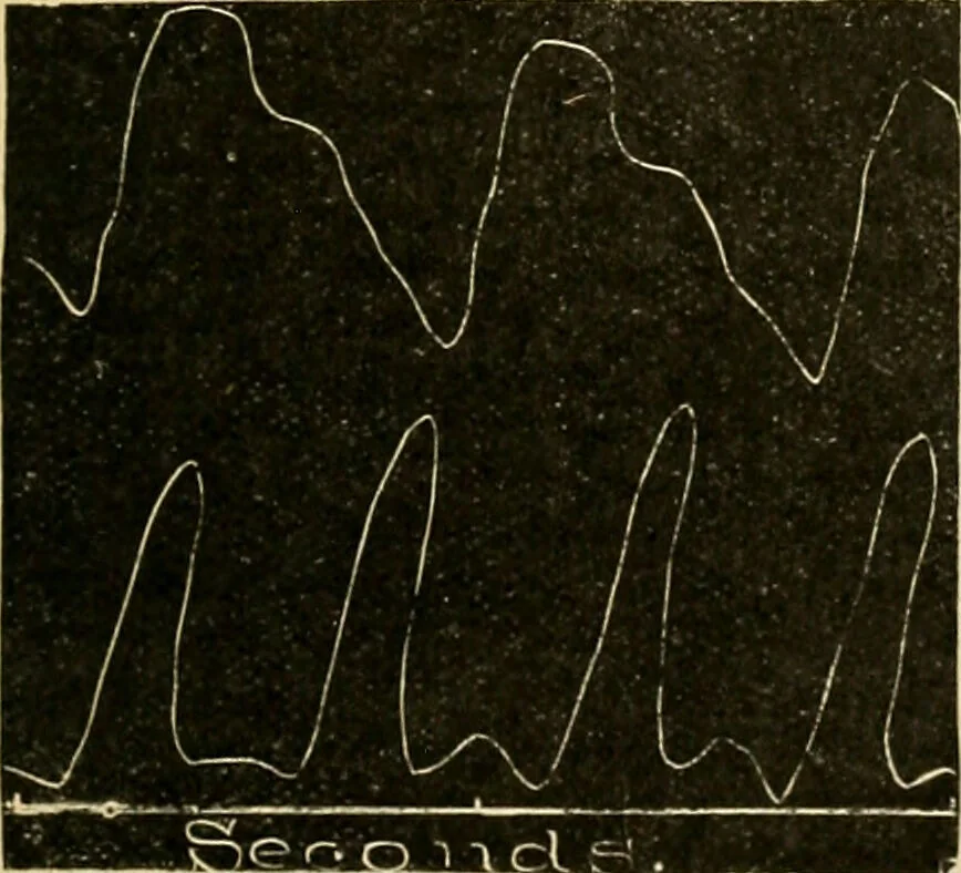 An illustration from A manual of physiology : with practical exercises / by G. N. Stewart ; with coloured plate and 467 other illustrations., 1914, leaf 231