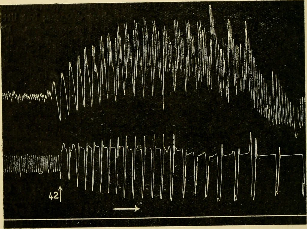 An illustration from A manual of physiology : with practical exercises / by G. N. Stewart ; with coloured plate and 467 other illustrations., 1914, leaf 260