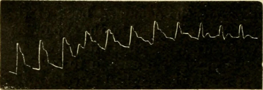 An illustration from A manual of physiology : with practical exercises / by G. N. Stewart ; with coloured plate and 467 other illustrations., 1914, leaf 314