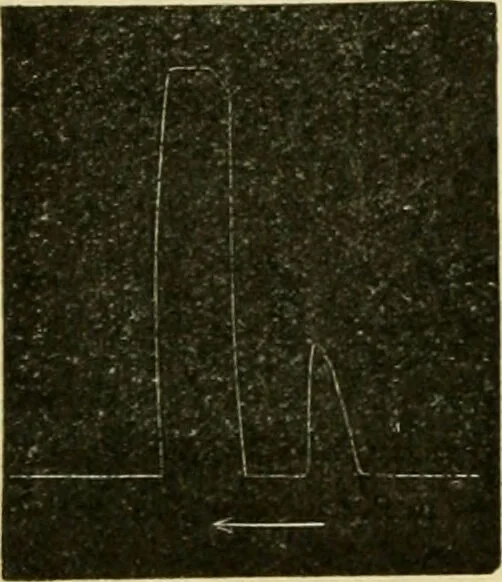 An illustration from A manual of physiology : with practical exercises / by G. N. Stewart ; with coloured plate and 467 other illustrations., 1914, leaf 784