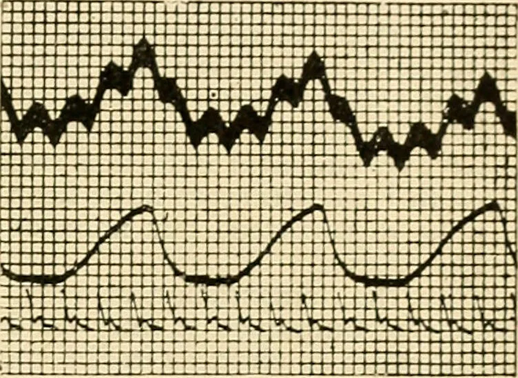 An illustration from A manual of physiology : with practical exercises / by G. N. Stewart ; with coloured plate and 467 other illustrations., 1914, leaf 825