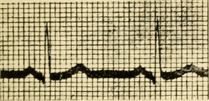 An illustration from A manual of physiology : with practical exercises / by G. N. Stewart ; with coloured plate and 467 other illustrations., 1914, leaf 833